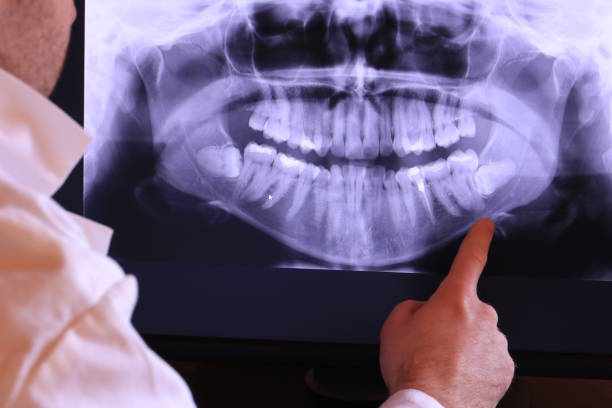 Best Knocked-Out Tooth Emergency  in Wilson, NC